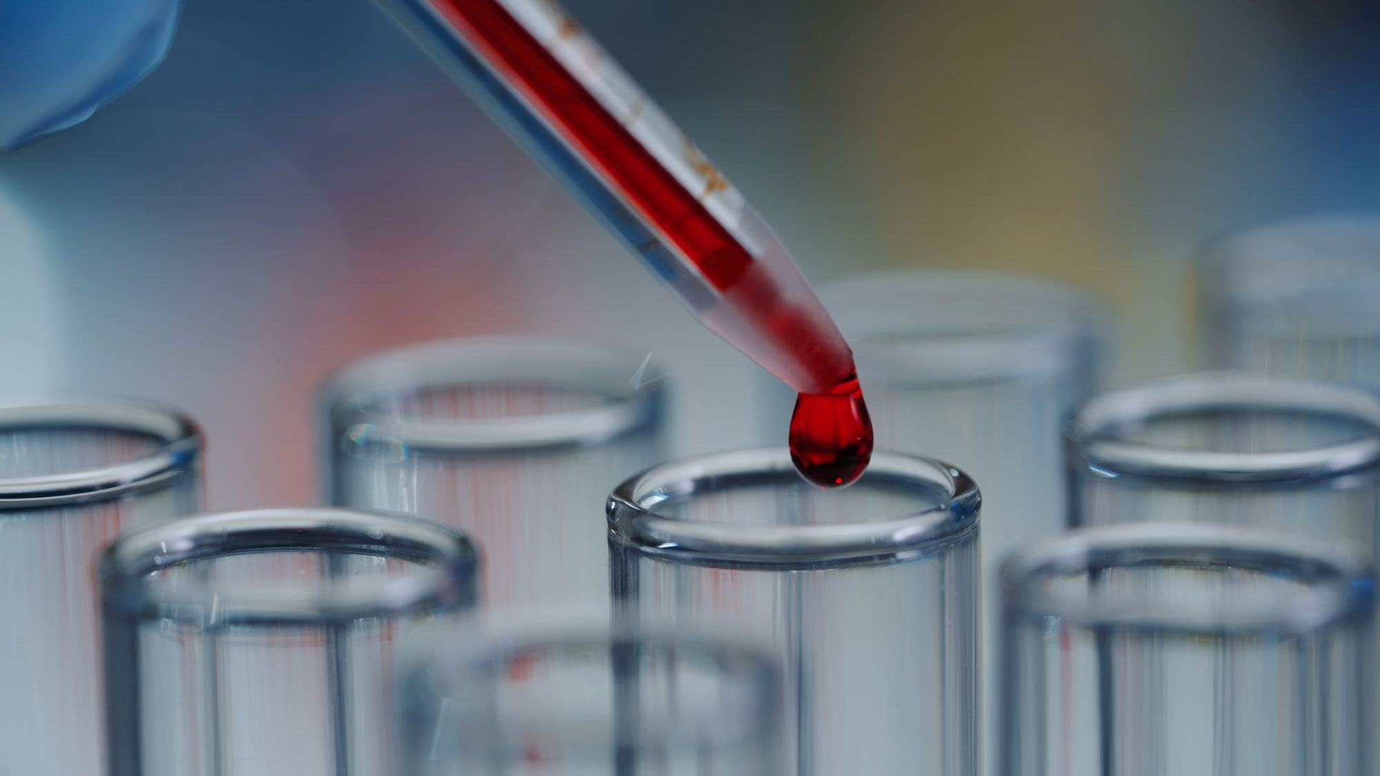 Executive Panel Blood Work: Comprehensive Laboratory Testing for Health Assessment Image